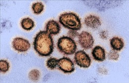 Phát hiện virus SARS-CoV-2 trong tinh dịch bệnh nhân nam