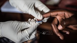 UNAIDS: Chấm dứt bạo lực là &#39;chìa khóa&#39; giúp giảm tỷ lệ nhiễm HIV/AIDS đối với phụ nữ 