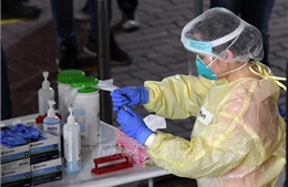 Singapore bắt đầu thử nghiệm giai đoạn cuối kháng thể chống virus SARS-CoV-2