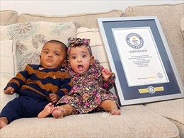 Hai em bé sinh non nhất thế giới đón sinh nhật đầu tiên