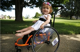 Bước tiến quan trọng trong phát hiện sớm và điều trị bệnh teo cơ tủy sống