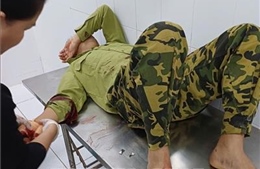 Đồng Nai: Bắt đối tượng chém trọng thương nhân viên bảo vệ rừng