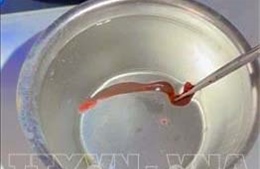 Quảng Trị: Gắp con đỉa sống dài 5cm trong mũi bệnh nhân