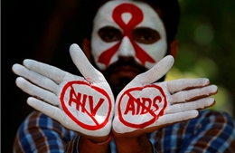 Loại thuốc mới có thể ngăn chặn virus AIDS lây truyền