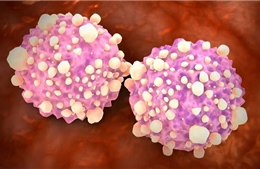 Xét nghiệm máu mới có thể phát hiện hơn 50 loại ung thư