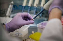 Triều Tiên tự sản xuất thiết bị xét nghiệm PCR để chẩn đoán COVID-19