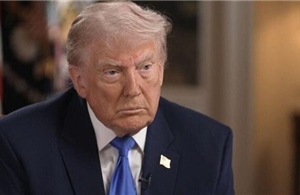 Nhà Trắng công bố báo cáo y tế, giải thích các vết bầm của Tổng thống Trump