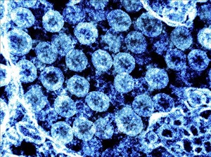 Biến thể phụ KP.2 của virus SARS-CoV-2 có thể lây lan nhanh hơn và &#39;né&#39; miễn dịch tốt hơn