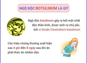 Ngộ độc Botulinum