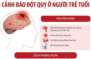 Cảnh báo đột quỵ ở người trẻ tuổi