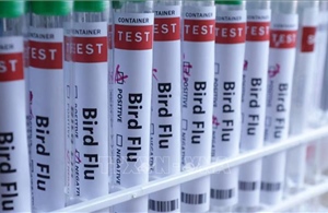 Nga cảnh báo dịch cúm A tiếp tục gia tăng