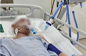 Học sinh lớp 8 bị đánh chết não đã tử vong tại Bệnh viện Nhi Trung ương