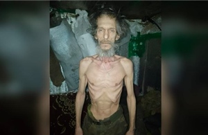 Hình ảnh binh sĩ suy kiệt phơi bày bê bối hậu cần trong quân đội Ukraine