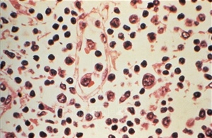 Argentina đặt những chiếc bẫy đầu tiên nhằm tóm vật chủ mang virus Hanta