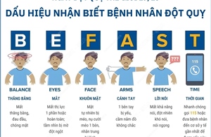 Quy tắc BE FAST: Dấu hiệu nhận biết sớm về đột quỵ