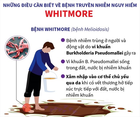 Bệnh truyền nhiễm nguy hiểm Whitmore: Những điều cần biết