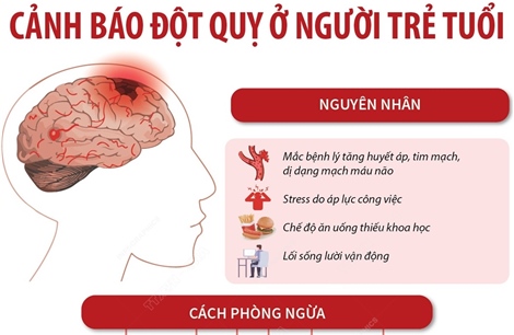 Cảnh báo đột quỵ ở người trẻ tuổi