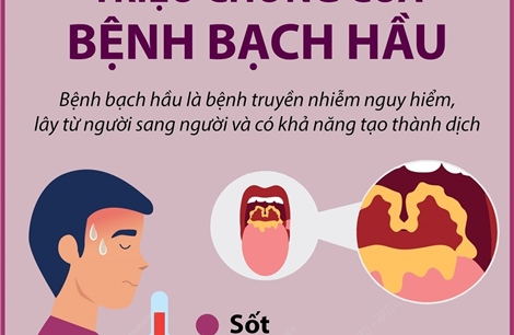 Triệu chứng của bệnh bạch hầu