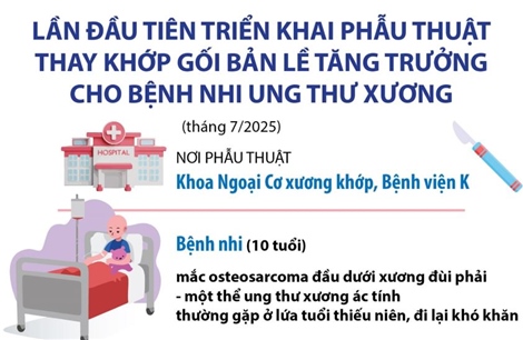 Lần đầu tiên triển khai phẫu thuật thay khớp gối bản lề tăng trưởng cho bệnh nhi ung thư xương
