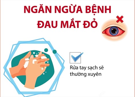 Ngăn ngừa bệnh đau mắt đỏ