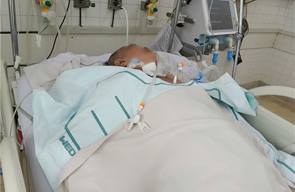 TP Hồ Chí Minh: Gia tăng ca viêm não do zona thần kinh