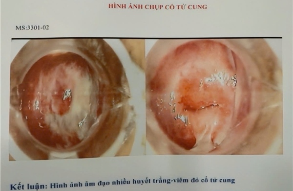 TP Hồ Chí Minh: Phát hiện hàng trăm hình ảnh nội soi cổ tử cung ‘vô danh’ tại một phòng khám