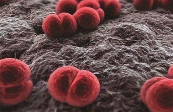 Tưởng viêm họng nhẹ, bé gái 11 tuổi bị co giật, tổn thương thận do biến chứng