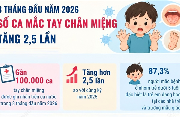 Số ca mắc tay chân miệng tăng 2,5 lần