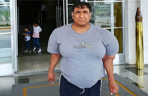 Cơ thể phồng như bóng hơi suốt 10 năm sau sự cố khi lặn biển