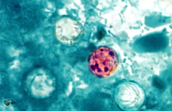 Ký sinh trùng Cyclospora là gì và vì sao đang gây lo ngại tại Mỹ?