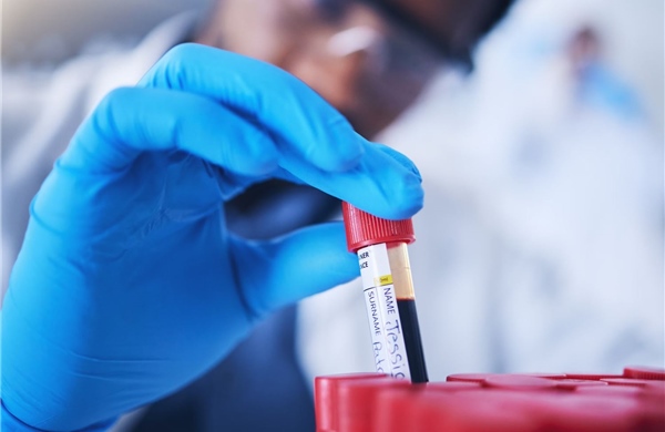 Chỉ cần xét nghiệm máu có thể dự báo sớm bệnh tim di truyền phổ biến nhất thế giới