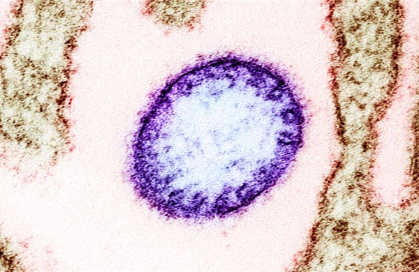 Các cơ sở y tế chủ động phòng, chống  bệnh do virus Nipah