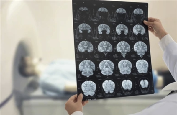 AI mở ra hướng giải mã những bí ẩn y học cho bệnh nhân