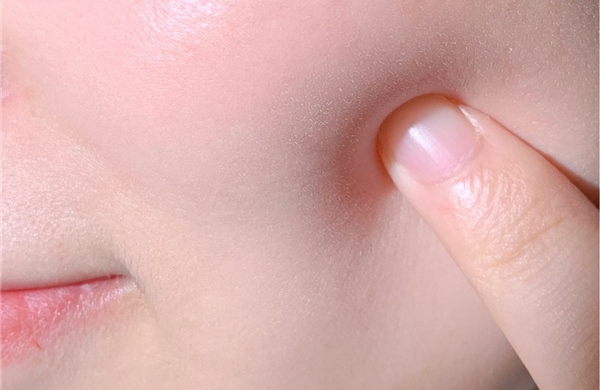 Giải pháp giúp kéo dài tuổi thọ làn da