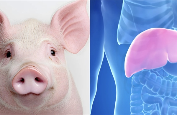 Gan lợn biến đổi gene mở ra hướng đi mới trong điều trị suy gan cấp
