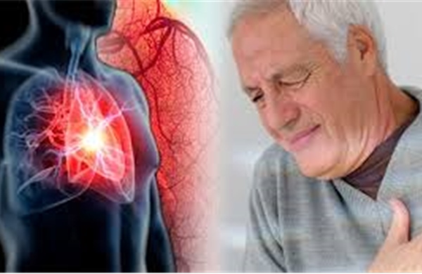 Chuyên gia cảnh báo mối liên quan giữa suy tim và bệnh mạn tính