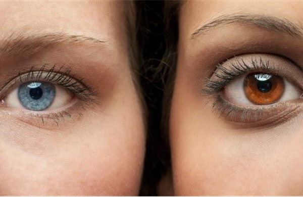 Ca phẫu thuật đổi màu mắt đầu tiên tại Nam Phi