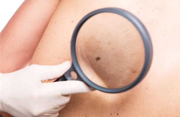 AI tạo protein trị ung thư, biết &#39;định vị như Google Maps&#39; tới khối u