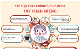 Các biện pháp phòng chống bệnh tay chân miệng